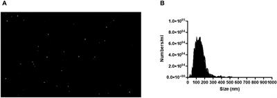 Leishmania braziliensis exosomes activate human macrophages to produce proinflammatory mediators